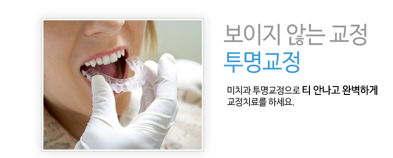 보이지 않는 교정 투명교정 - 미치과 투명교정으로 티 안나고 완벽하게 교정치료를 하세요.