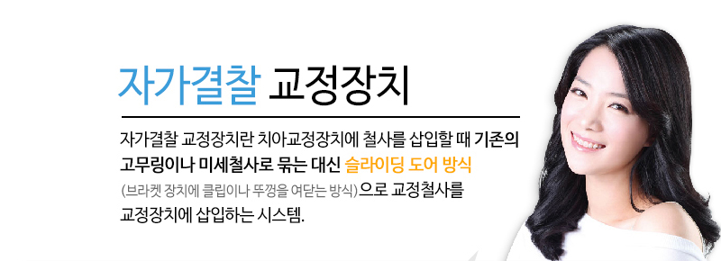 자가결찰 교정장치 - 자가결찰 교정장치란 치아교정장치에 철사를 삽입할 때 기존의 고무링이나 미세철사로 묶는 대신 슬라이딩 도어 방식(브라켓 장치에 클립이나 뚜껑을 여닫는 방식)으로 교정철사를 교정장치에 삽입하는 시스템.